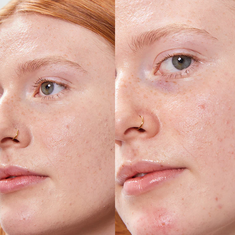 Bálsamo Corrector Natural 5 g - Image 11
