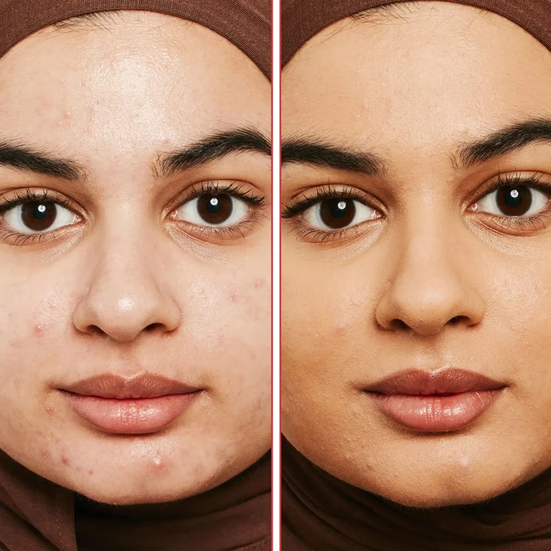 Erborian Super BB Concealer DORÉ 10 ml - Image 3