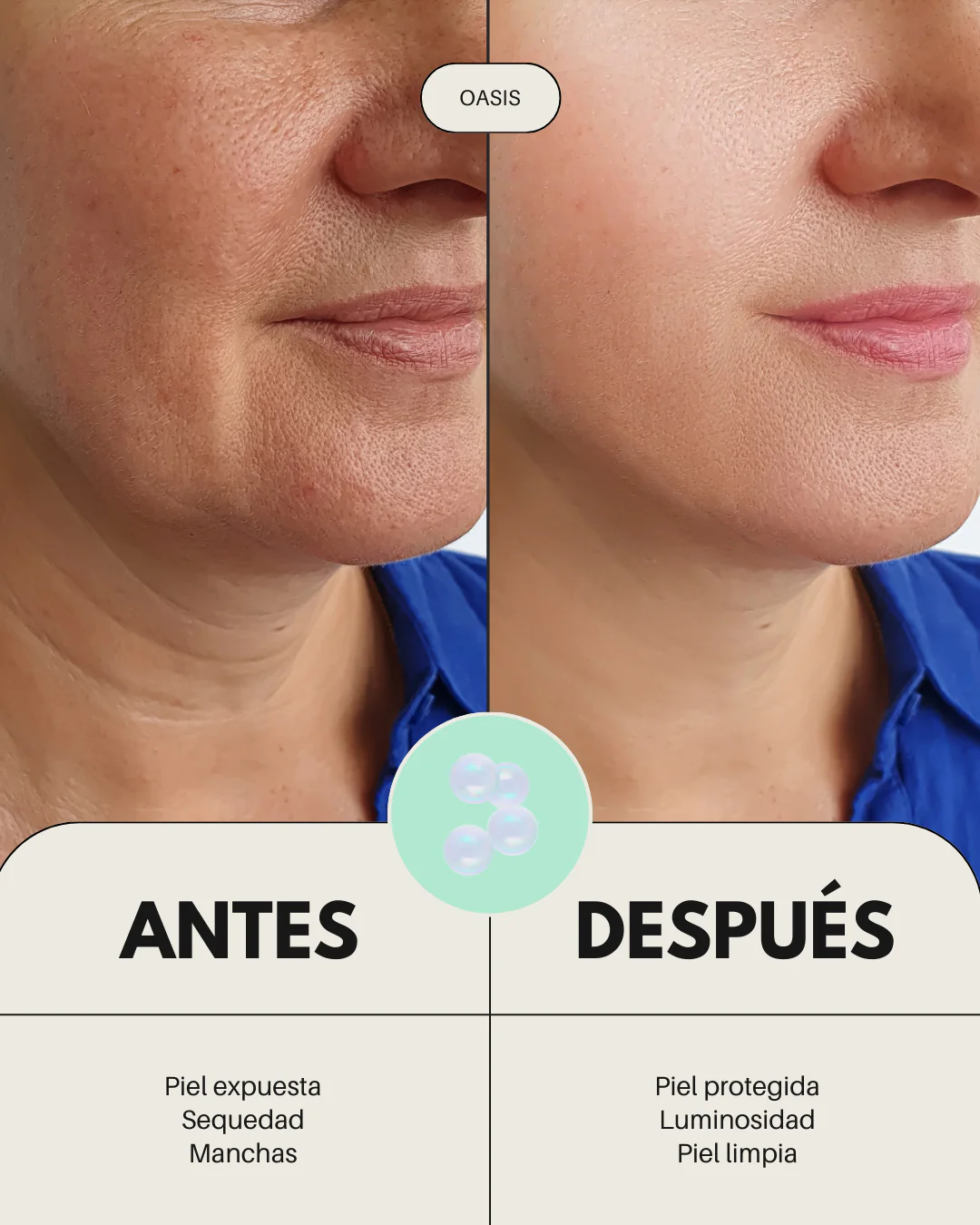 Banbu Pack Rutina Facial Completa Piel Seca - Image 4